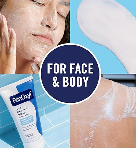 Acne Creamy Wash, 4% Benzoyl Peroxide