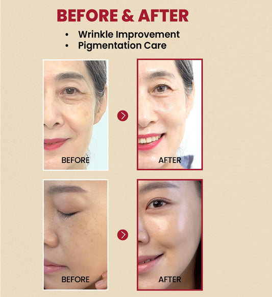 KSECRET - SEOUL 1988 Serum : Retinal Liposome 2% + Black Ginseng