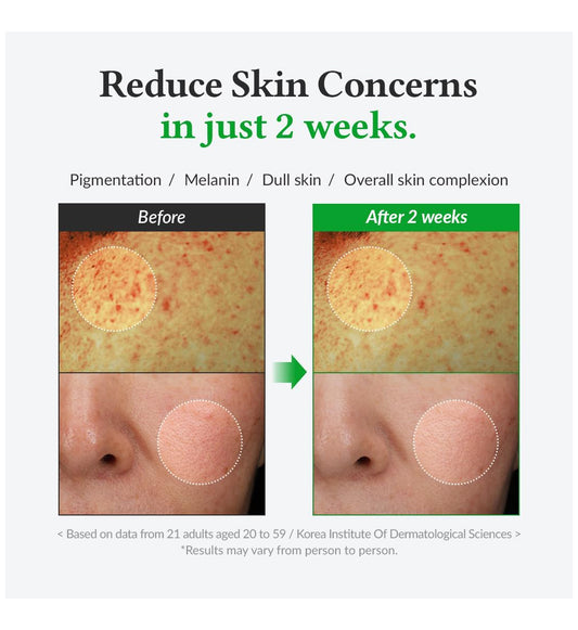 Dr. Althea Gentle Vitamin C Serum 20%