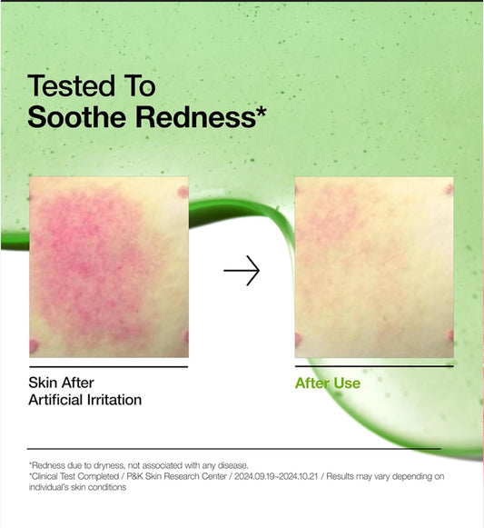 Anua - Azelaic Acid 10 Hyaluron Redness Soothing Serum