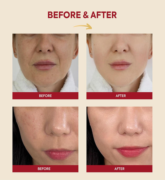 K S-ECRET SEOUL 1988 Essence : Snail Mucin 97% + Rice