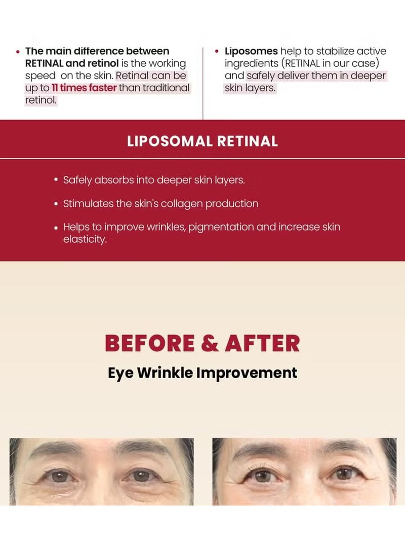 KSECRET - SEOUL 1988 Eye Cream : Retinal Liposome 4% + Fermented Bean