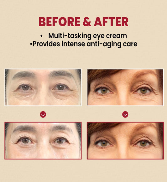 KSECRET - SEOUL 1988 Eye Cream : Retinal Liposome 4% + Fermented Bean