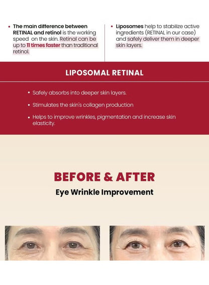 KSECRET - SEOUL 1988 Eye Cream : Retinal Liposome 4% + Fermented Bean